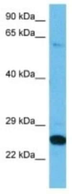 TLCD3A Rabbit anti-Human, Polyclonal, Novus Biologicals 100 &mu;g; Unconjugated:Antibodies,